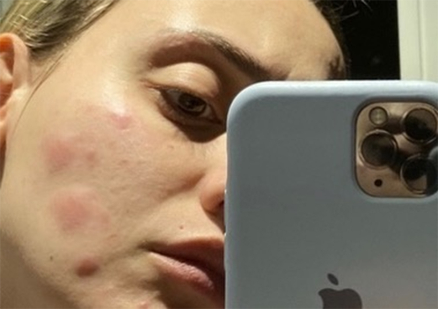 Κορακάκη: Συγκλονιστική ανάρτηση για τον stalker που της είχε κάνει τη ζωή κόλαση