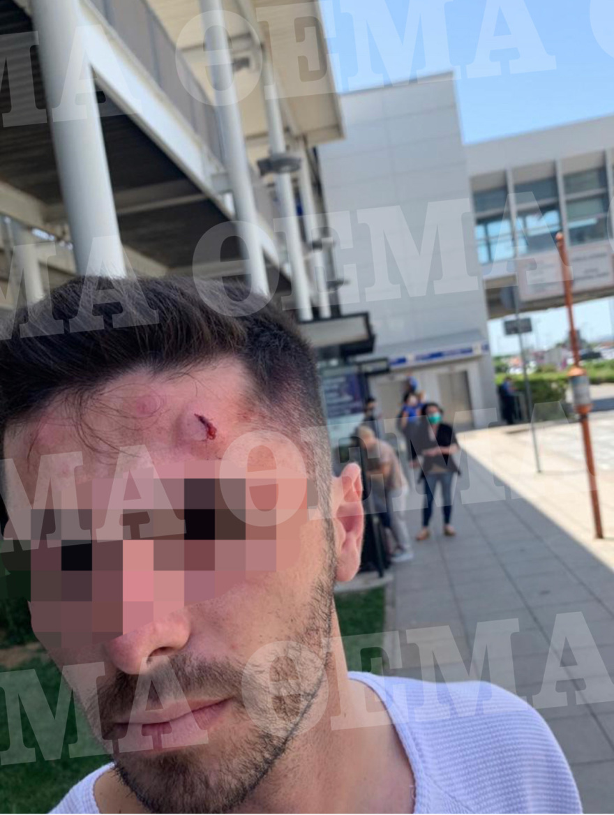 «Ελευθέριος Βενιζέλος»: Ταξιτζής ξυλοκόπησε οδηγό transfer στο αεροδρόμιο