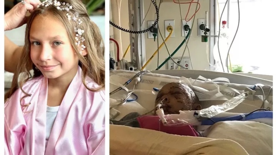 ΗΠΑ: Επίθεση πούμα σε 9χρονη - Σοβαρά τραυματισμένο το κορίτσι