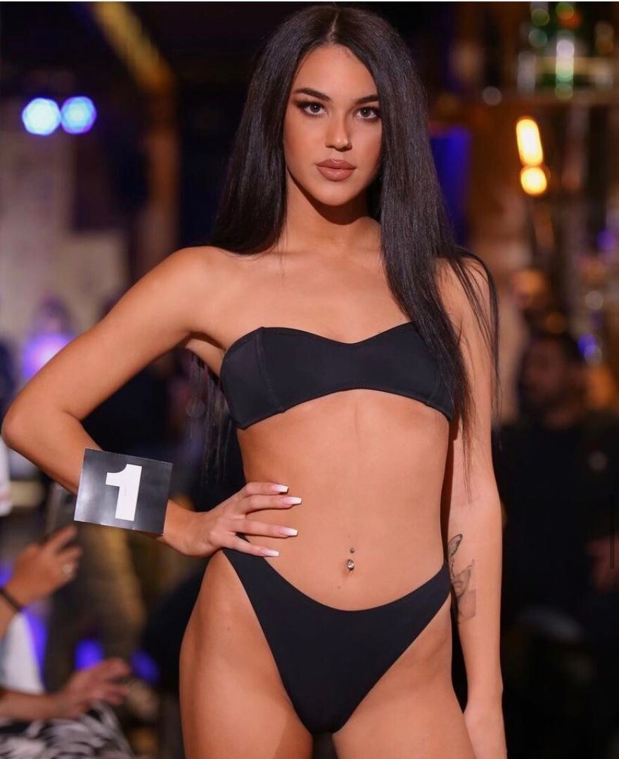 Το μοντέλο Ειρήνη Βολιώτη κατήγγειλε για ξυλοδαρμό τον πρώην σύντροφό της