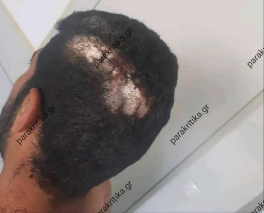 Κρήτη: Ζήτησε από τον εργοδότη του να τον πληρώσει και εκείνος... τον ξυλοφόρτωσε 