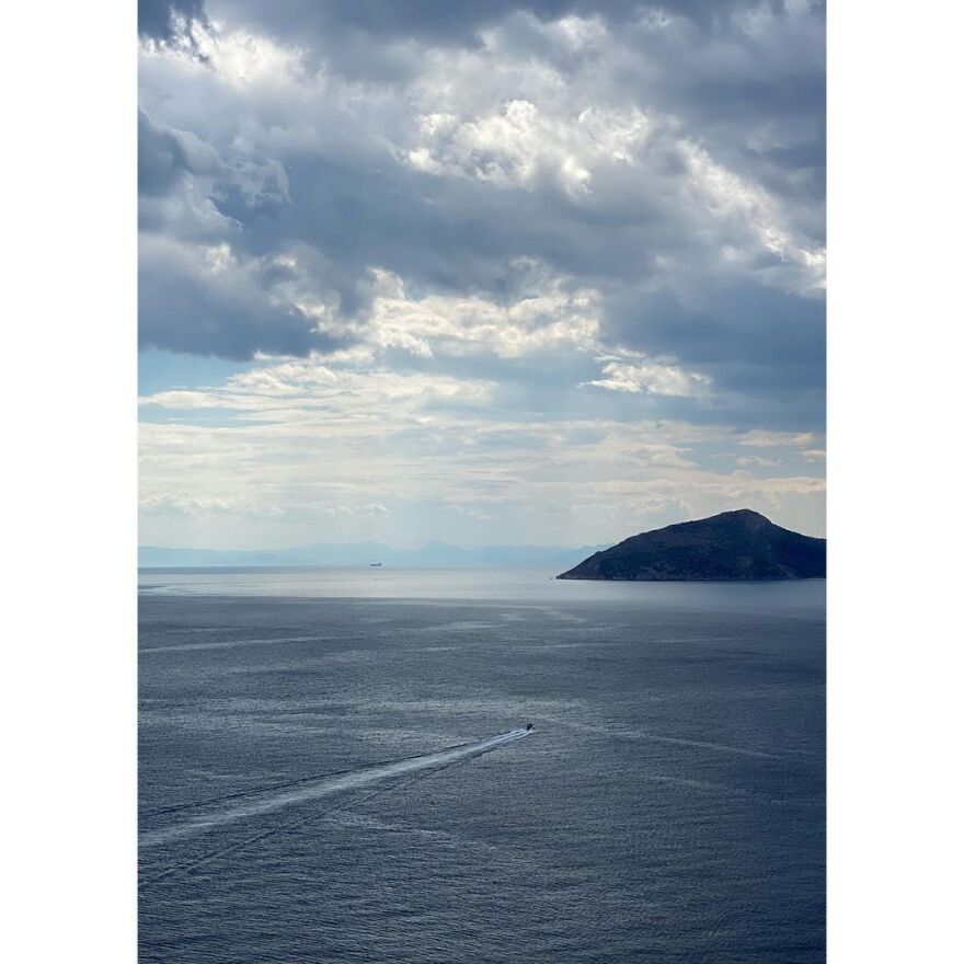 Ολυμπία Κρασαγάκη για τον καρκίνο: «Δεν πενθώ για τα μακριά κυματιστά μαλλιά μου»