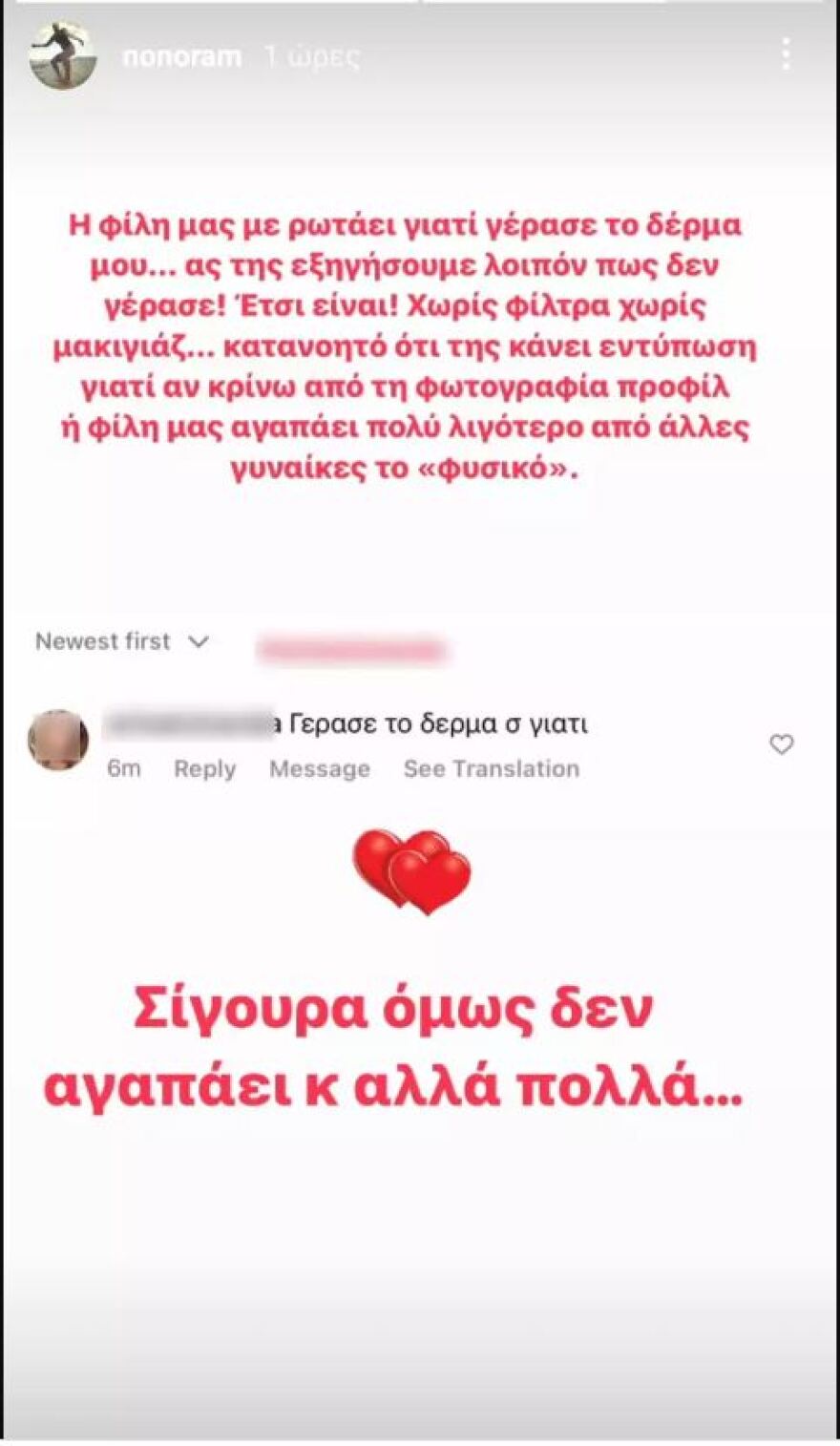 Ελεονώρα Μελέτη: Follower την ρώτησε «γιατί γέρασε το δέρμα σου;» - Η απάντηση της παρουσιάστριας