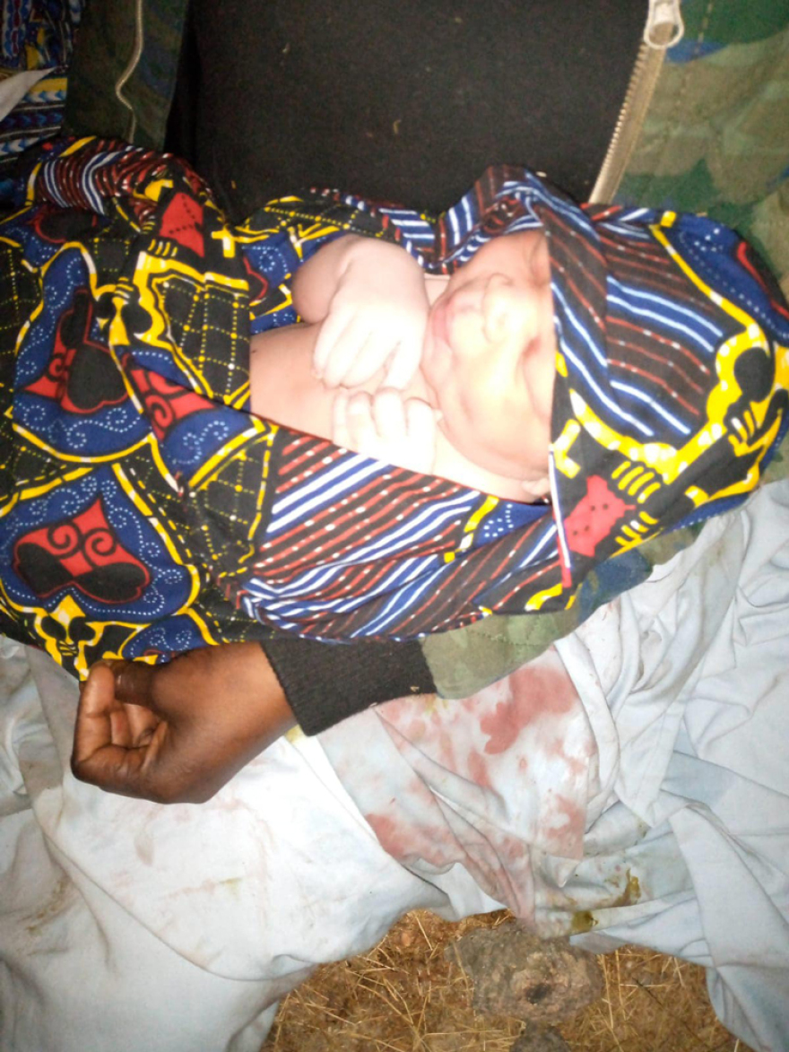 Μυτιλήνη: Μετανάστρια γέννησε σε βραχονησίδα - Δείτε φωτογραφίες με το βρέφος