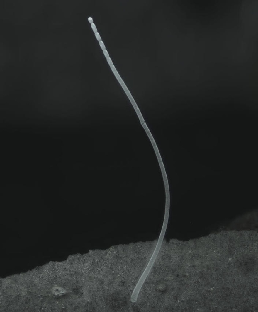 Βρέθηκε στη Γουαδελούπη βακτήριο «γίγας»: Είναι ορατό δια γυμνού οφθαλμού και πιάνεται με τσιμπιδάκι