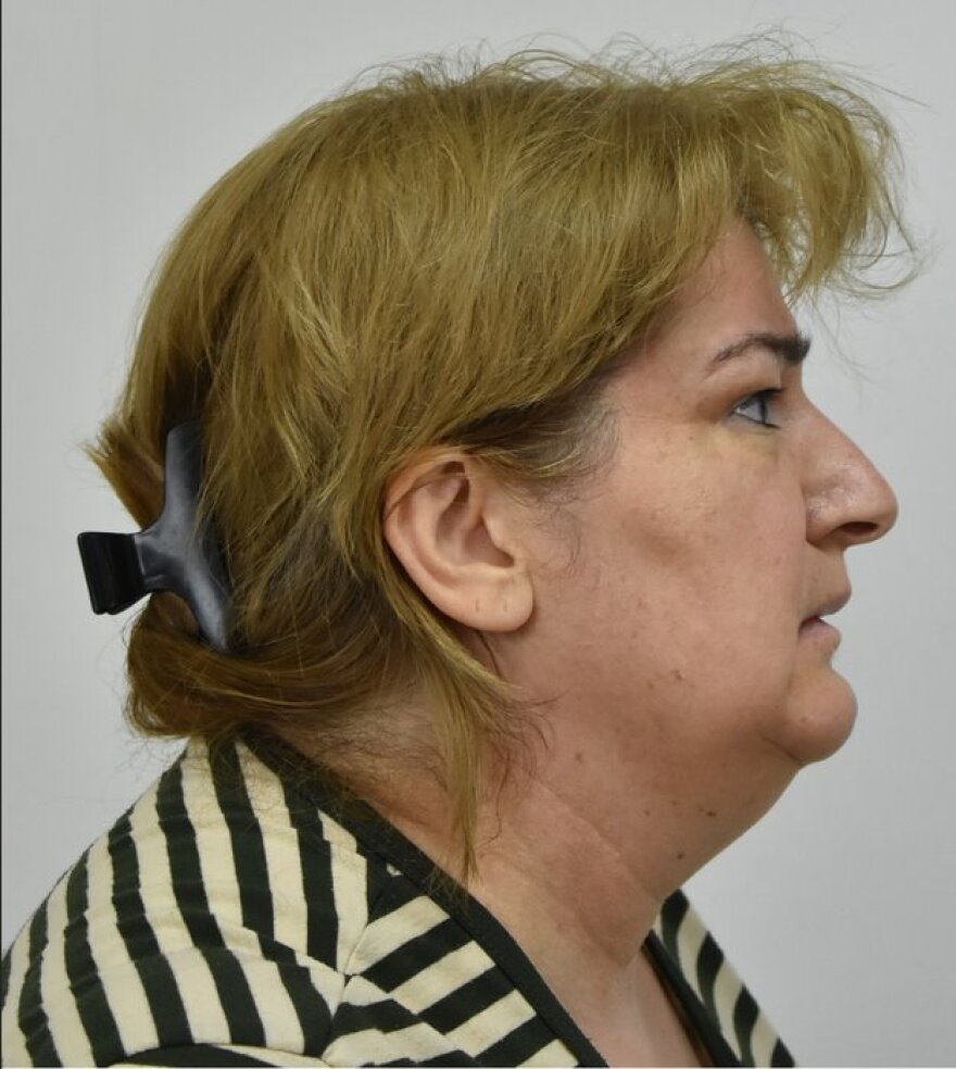 ΕΛ.ΑΣ.: Αυτή είναι η Γεωργιανή γυναίκα-«αράχνη» που νάρκωνε και έκλεβε ηλικιωμένους 