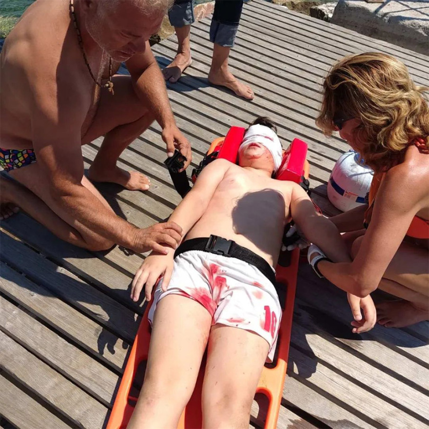 Πώς έγινε το ατύχημα με τον 11χρονο στις Αλυκές Βόλου