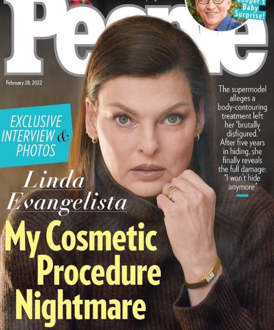 Λίντα Εβαντζέλιστα: Επιστρέφει στις πασαρέλες μετά την παραμόρφωση από τις πλαστικές