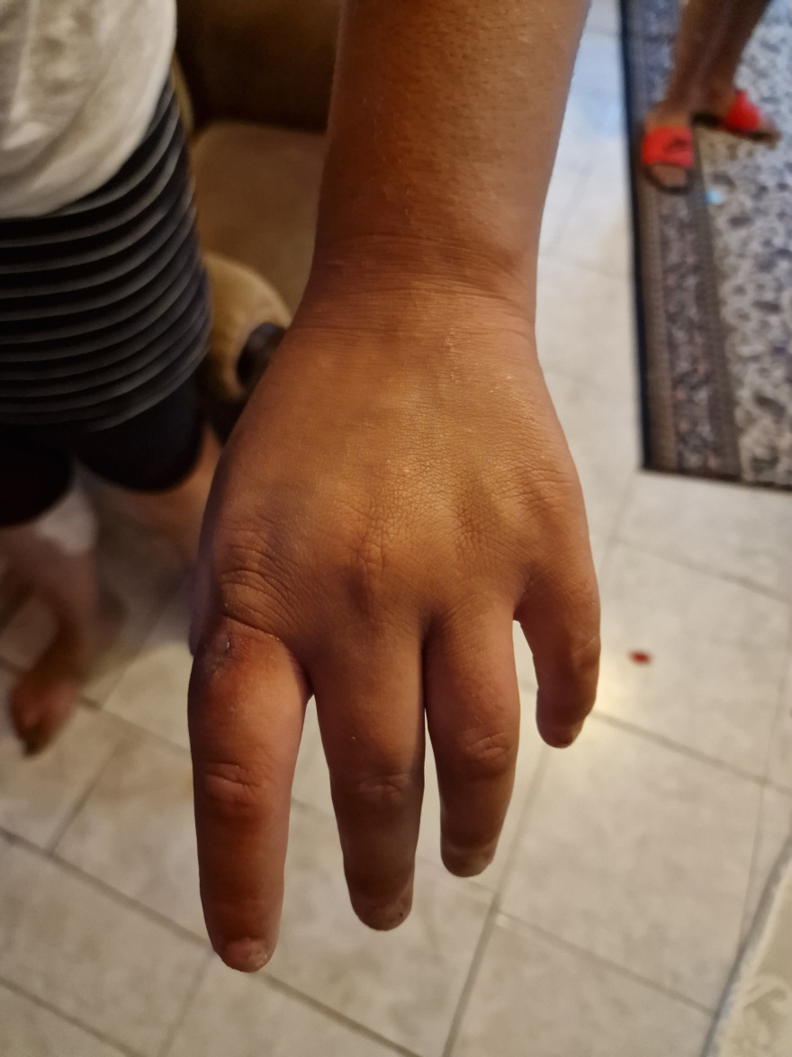 Αυτό είναι το ζευγάρι που προκάλεσε «βεντέτα» μεταξύ δύο οικογενειών Τσιγγάνων στη Θεσσαλονίκη