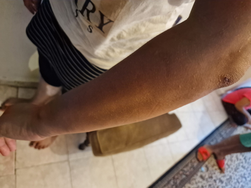 Αυτό είναι το ζευγάρι που προκάλεσε «βεντέτα» μεταξύ δύο οικογενειών Τσιγγάνων στη Θεσσαλονίκη