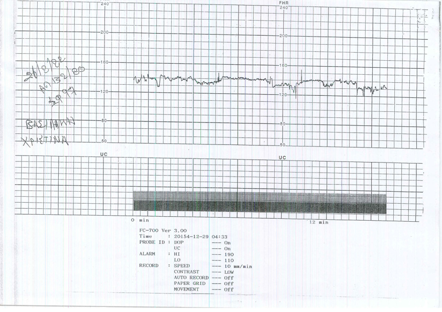 Θεσσαλονίκη: «Στο Ιπποκράτειο μου είπαν να φύγετε, να πάτε αλλού», λέει η 30χρονη που έχασε το νεογέννητο παιδί της