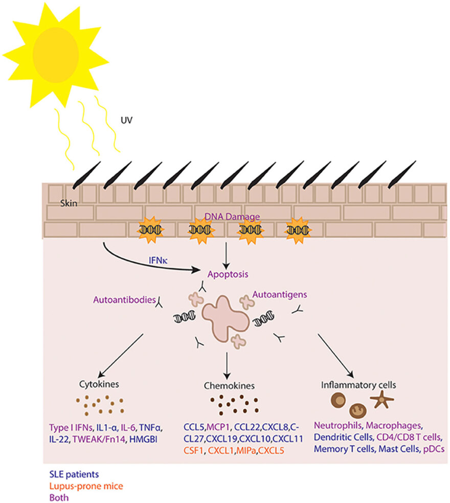 Ηλιακή ακτινοβολία και αυτοάνοσα ρευματικά νοσήματα: Φίλοι ή εχθροί;