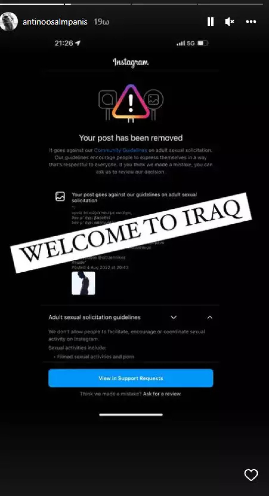 Αντίνοος Αλμπάνης: Η απάντηση του ηθοποιού για τη γυμνή φωτογραφία του, που κατέβηκε από το Instagram