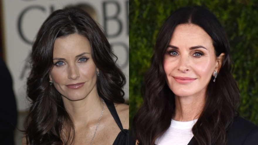 Πέντε διάσημες που μετάνιωσαν για τις πλαστικές που έκαναν