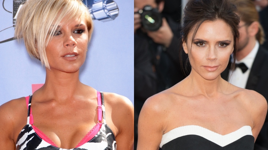 Πέντε διάσημες που μετάνιωσαν για τις πλαστικές που έκαναν