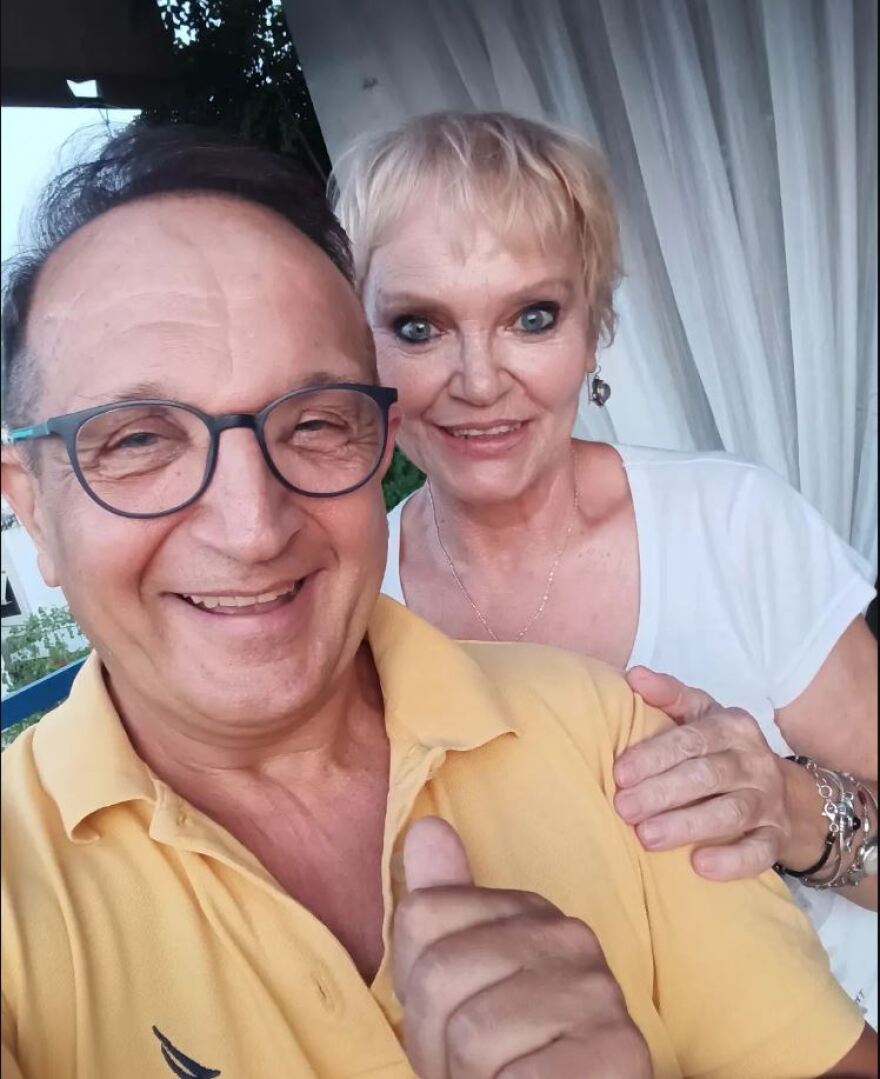 Σπύρος Μπιμπίλας: Οι πρώτες φωτογραφίες μετά τη μεταμόσχευση μαλλιών