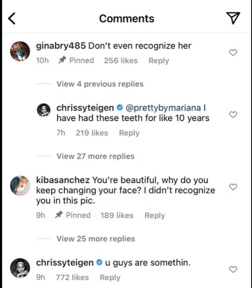 Κρίσι Τέιγκεν: Εκνευρισμένη με όσους της λένε πως «δεν την αναγνωρίζουν» σε νέα φωτογραφία