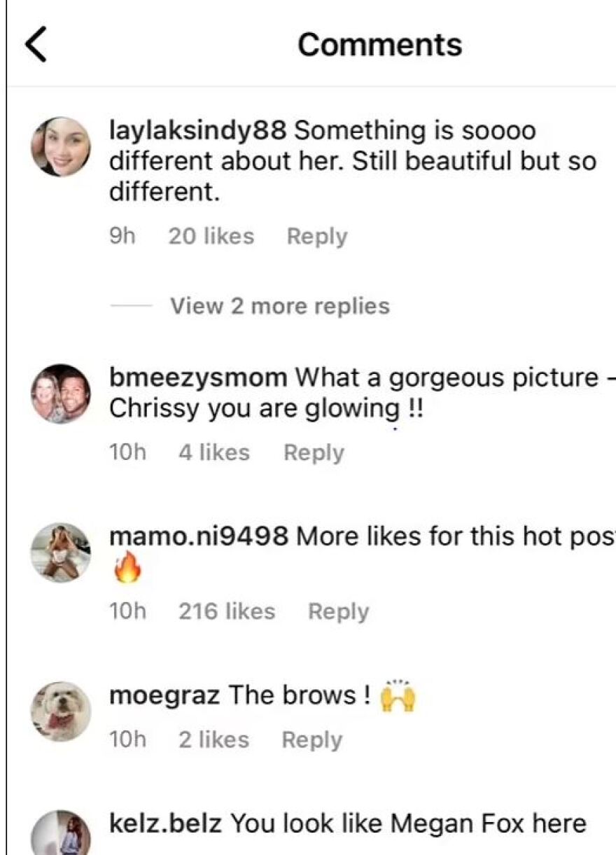 Κρίσι Τέιγκεν: Εκνευρισμένη με όσους της λένε πως «δεν την αναγνωρίζουν» σε νέα φωτογραφία