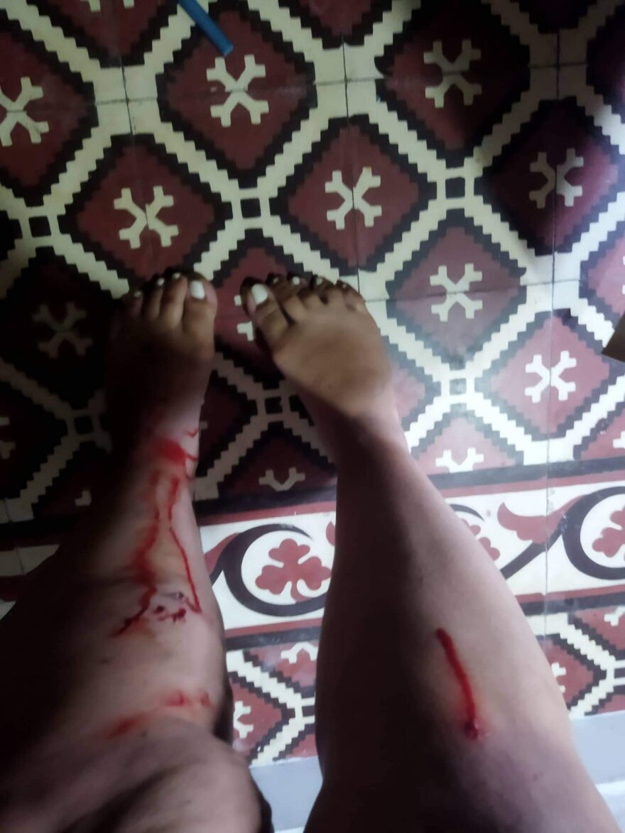 Βόλος: Ελεύθερος ο 36χρονος που απείλησε με κατσαβίδι τη σύντροφό του - Φοβάται για τη ζωή της η 26χρονη