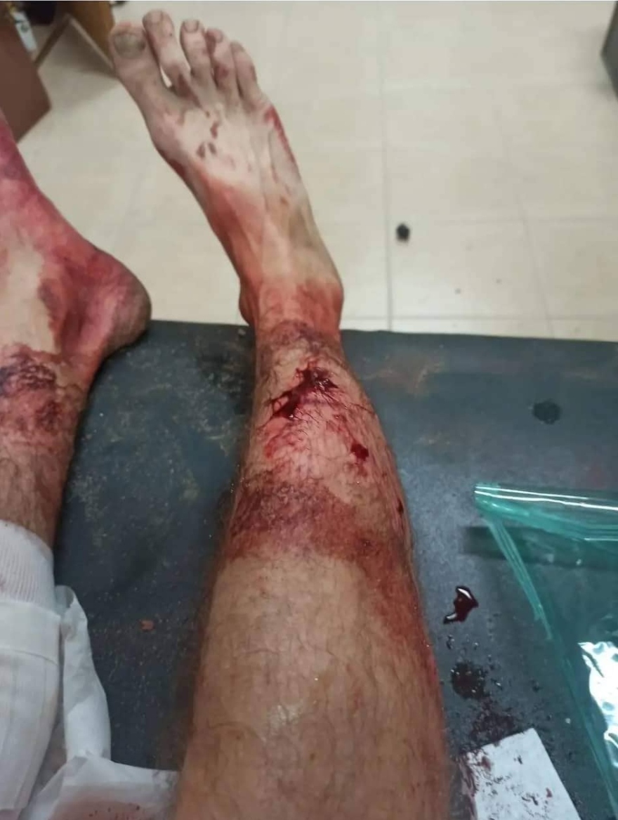 Γαύδος: Τα ροτβάιλερ που επιτέθηκαν σε 39χρονη, το έχουν κάνει ξανά - Δείτε την καταγγελία και φωτογραφίες