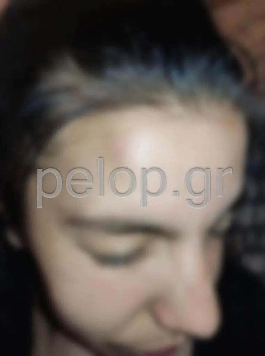 Πάτρα: Θύμα κακοποίησης 16χρονη από τον 25χρονο σύντροφό της - Έκκληση από τη μητέρα της