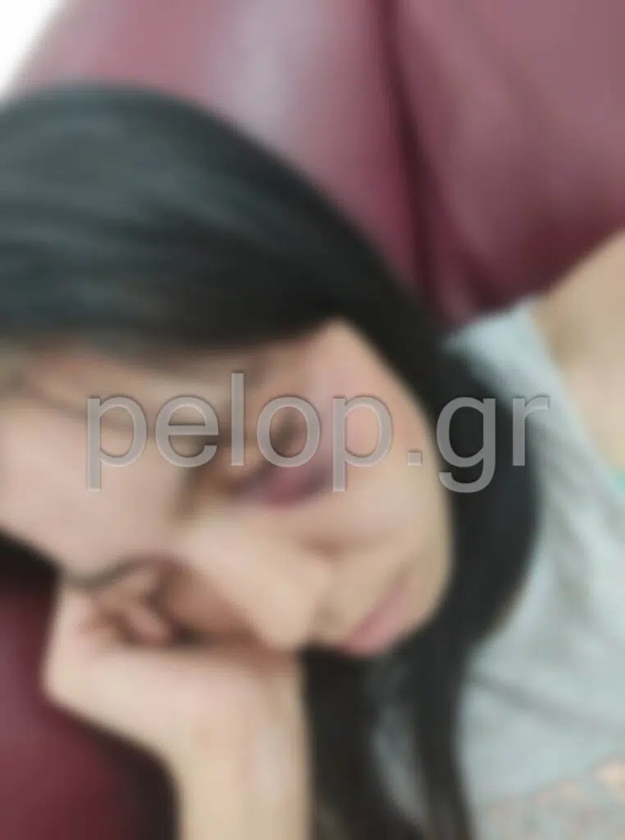 Πάτρα: Ρομά απήγαγε την 16χρονη κόρη τους και την ξυλοκόπησε