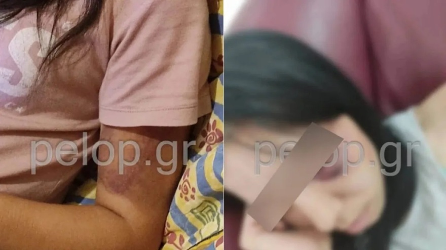 Πάτρα: Στη φυλακή ο 20χρονος που κατηγορείται για την αρπαγή της 16χρονης 