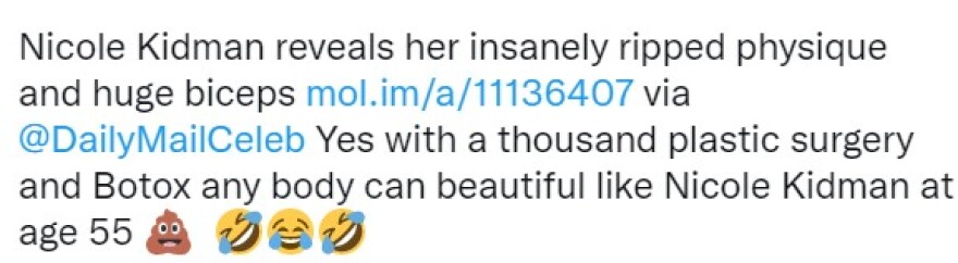 Νικόλ Κίντμαν: Δείχνει τους... παραγυμνασμένους δικέφαλούς της - Αντιδράσεις στα social media