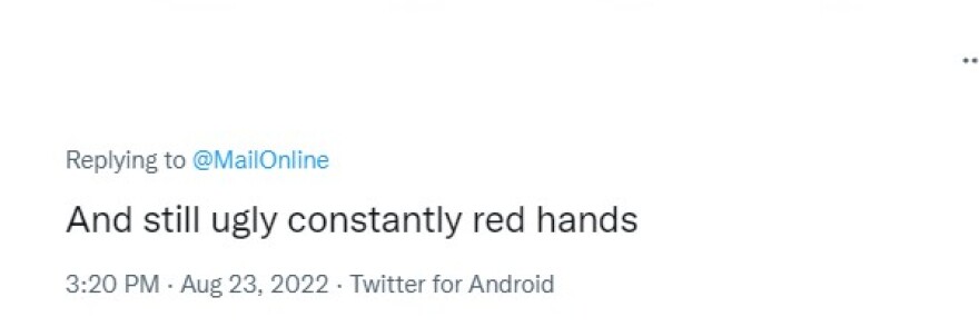 Νικόλ Κίντμαν: Δείχνει τους... παραγυμνασμένους δικέφαλούς της - Αντιδράσεις στα social media