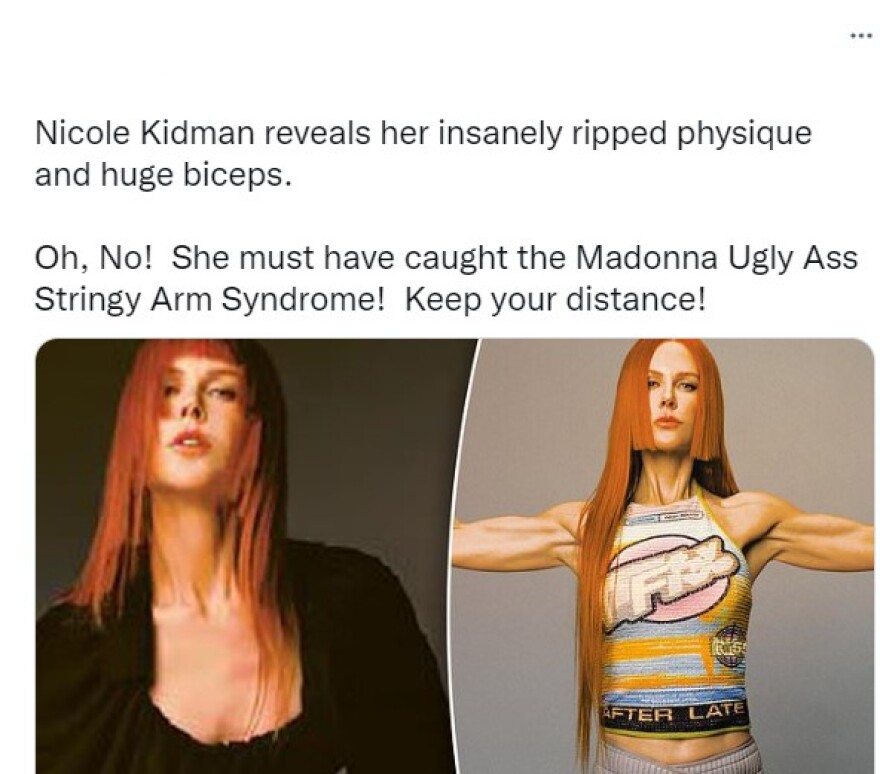 Νικόλ Κίντμαν: Δείχνει τους... παραγυμνασμένους δικέφαλούς της - Αντιδράσεις στα social media