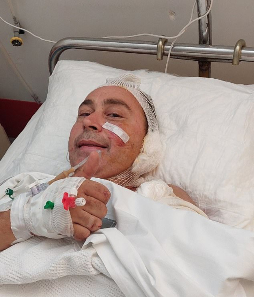 Αγέλη σκύλων επιτέθηκε σε οικογένεια Βρετανών στο Σουσάκι Κορινθίας - «Πιστέψαμε ότι θα πεθάνουμε», λέει ο πατέρας