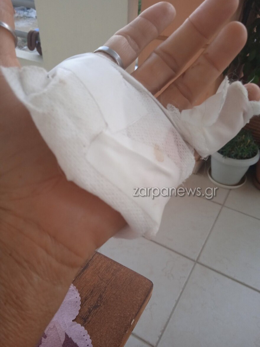 Χανιά: Σκληρές εικόνες από άγρια επίθεση σκύλου σε 57χρονη - «Τρέμω να βγω από το σπίτι» λέει