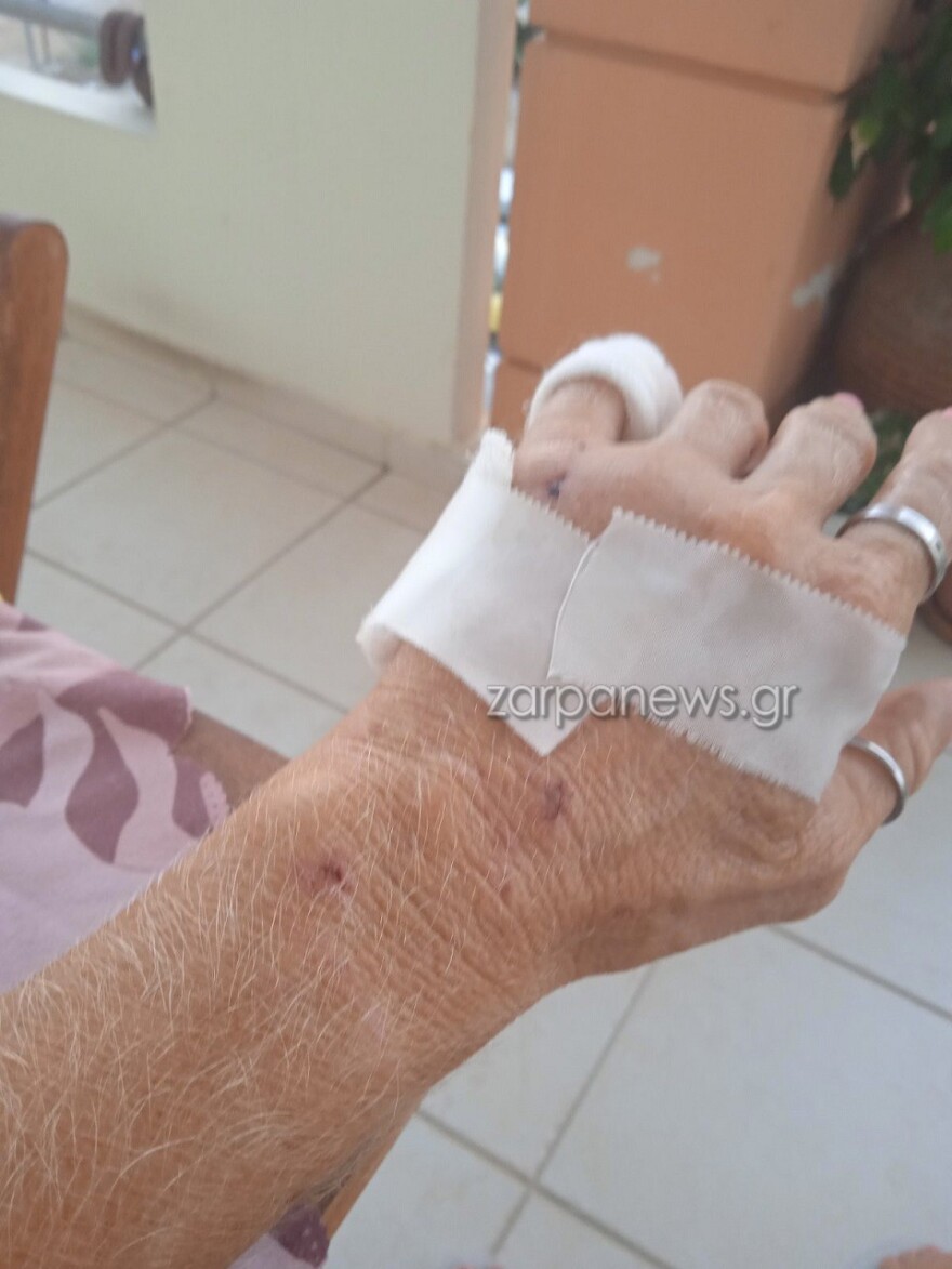 Χανιά: Σκληρές εικόνες από άγρια επίθεση σκύλου σε 57χρονη - «Τρέμω να βγω από το σπίτι» λέει