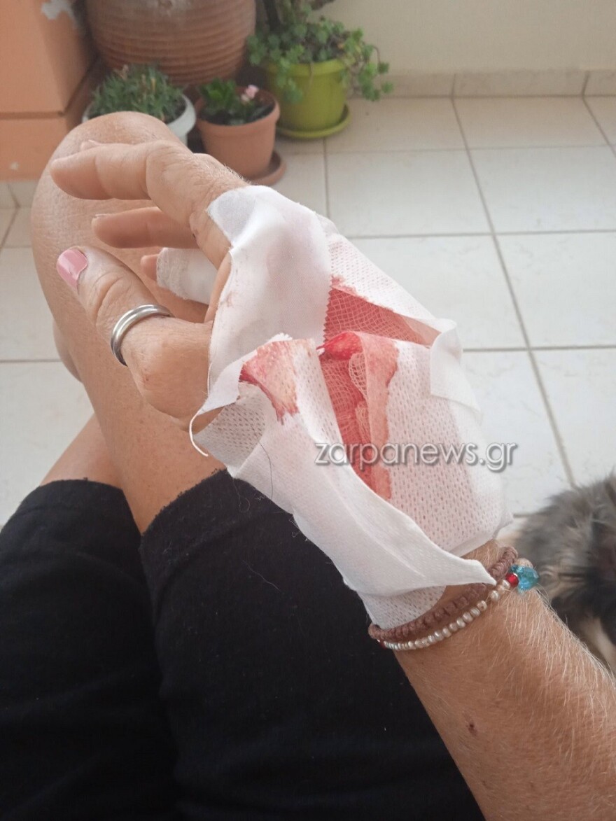 Χανιά: Σκληρές εικόνες από άγρια επίθεση σκύλου σε 57χρονη - «Τρέμω να βγω από το σπίτι» λέει