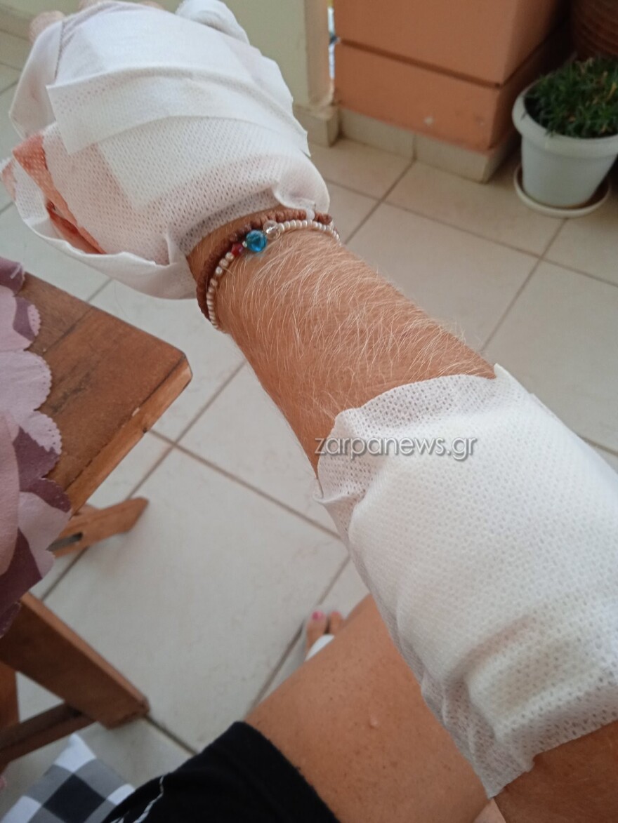 Χανιά: Σκληρές εικόνες από άγρια επίθεση σκύλου σε 57χρονη - «Τρέμω να βγω από το σπίτι» λέει