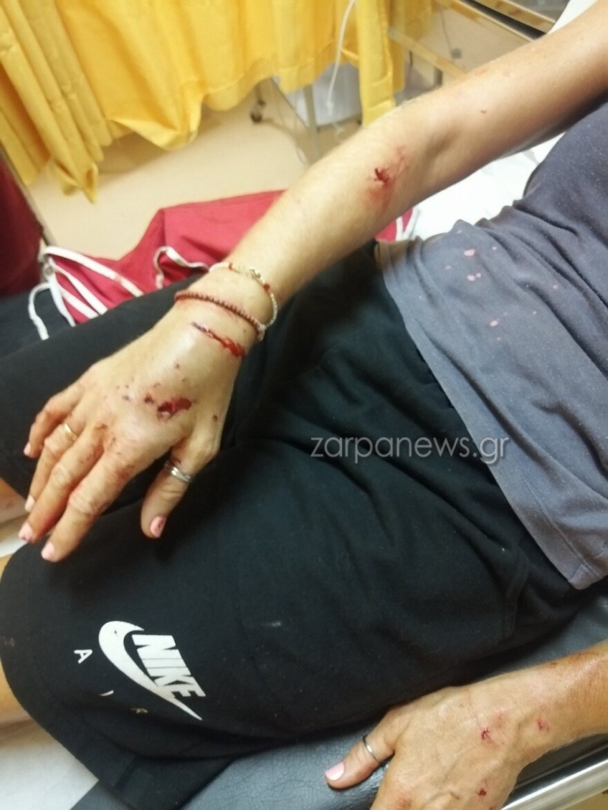 Χανιά: Σκληρές εικόνες από άγρια επίθεση σκύλου σε 57χρονη - «Τρέμω να βγω από το σπίτι» λέει