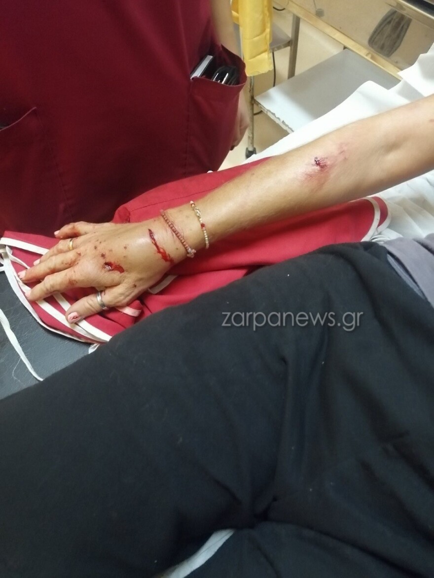 Χανιά: Σκληρές εικόνες από άγρια επίθεση σκύλου σε 57χρονη - «Τρέμω να βγω από το σπίτι» λέει