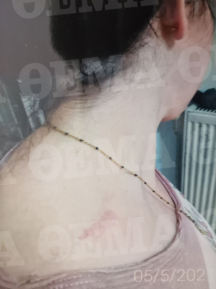 Θεσσαλονίκη: «Φοβάμαι για τη ζωή μου» - Οι καταθέσεις της 29χρονης που κακοποιείται από τον πρώην σύζυγό της