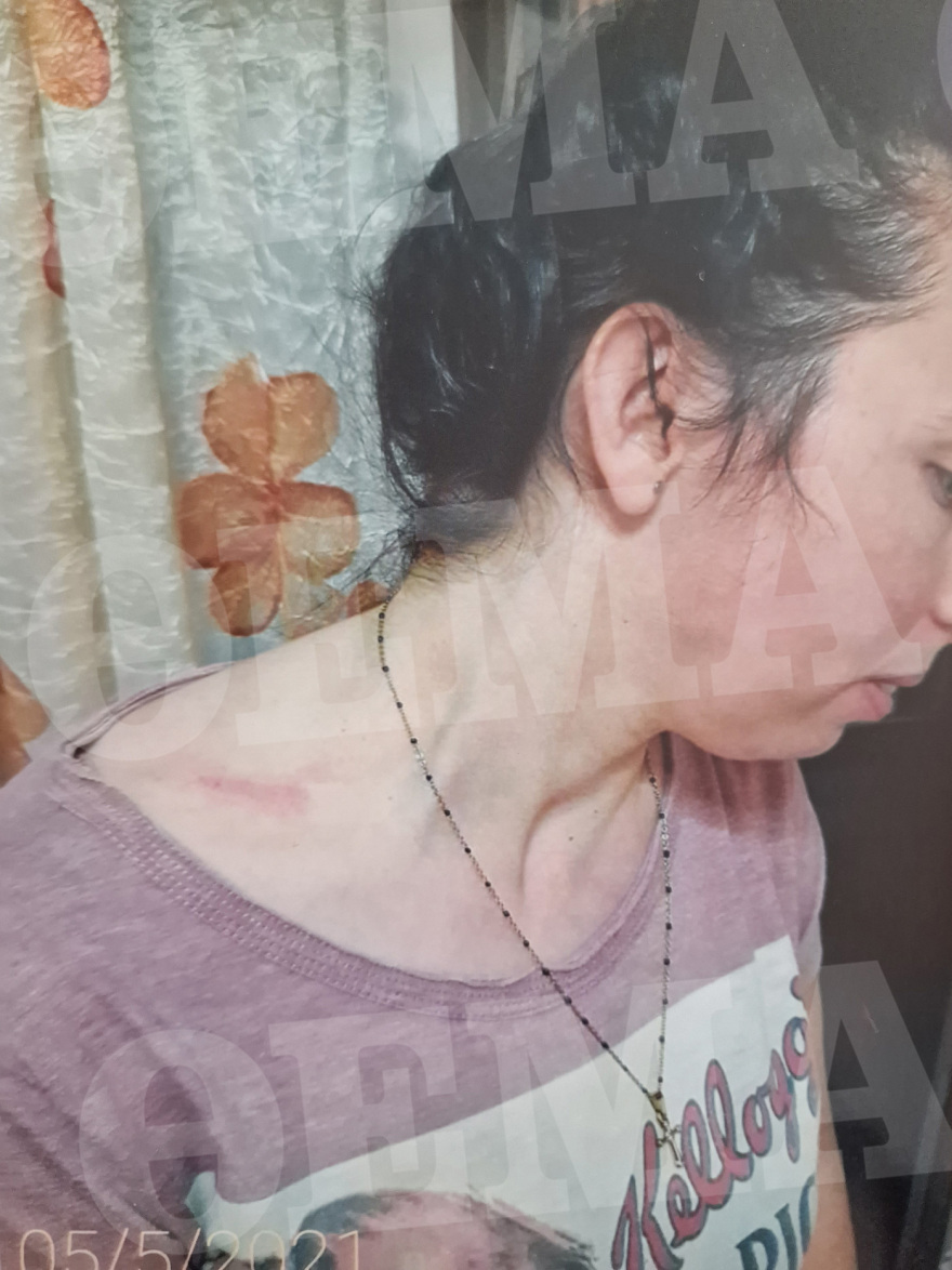 Θεσσαλονίκη: «Φοβάμαι για τη ζωή μου» - Οι καταθέσεις της 29χρονης που κακοποιείται από τον πρώην σύζυγό της