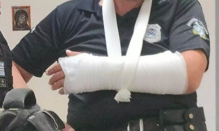 Φωτογραφίες από τους τραυματισμένους αστυνομικούς μετά την επίθεση από τουλάχιστον 20 άτομα στη Λάρισα