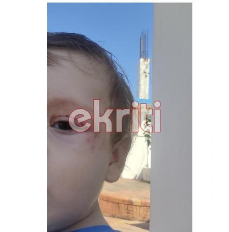 Κρήτη: Στο ΠΑΓΝΗ το βρέφος που γλίτωσε από τα δόντια του λυκόσκυλου - Δείτε φωτογραφίες