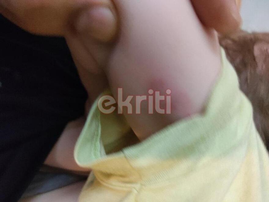 Κρήτη: Στο ΠΑΓΝΗ το βρέφος που γλίτωσε από τα δόντια του λυκόσκυλου - Δείτε φωτογραφίες