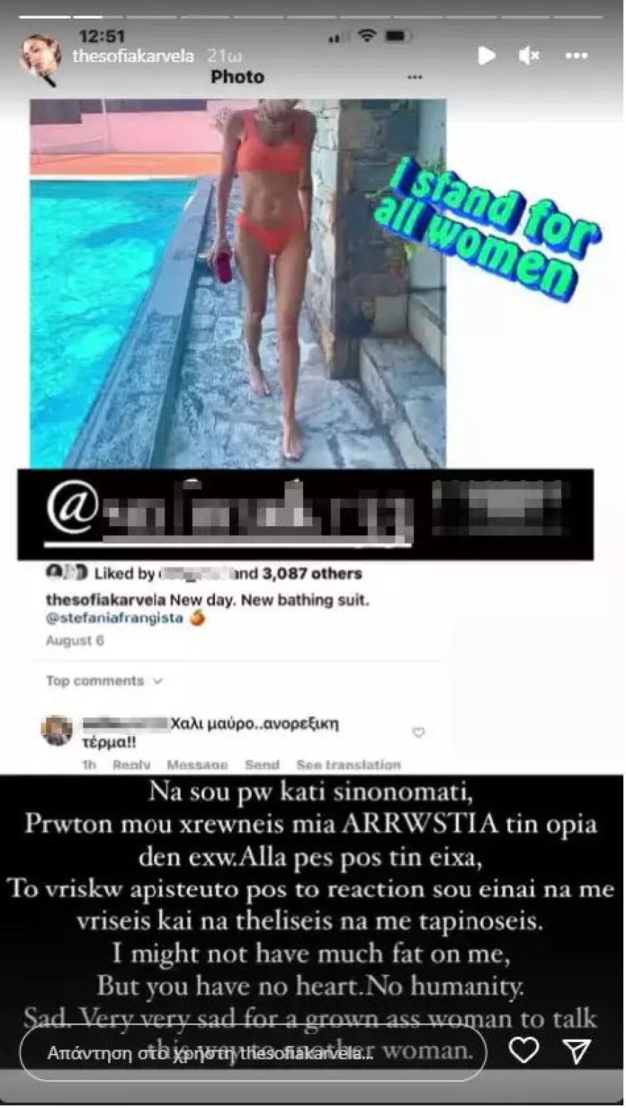 Σοφία Καρβέλα: Το ξέσπασμά της κατά follower που της γράφει ότι έχει νευρική ανορεξία