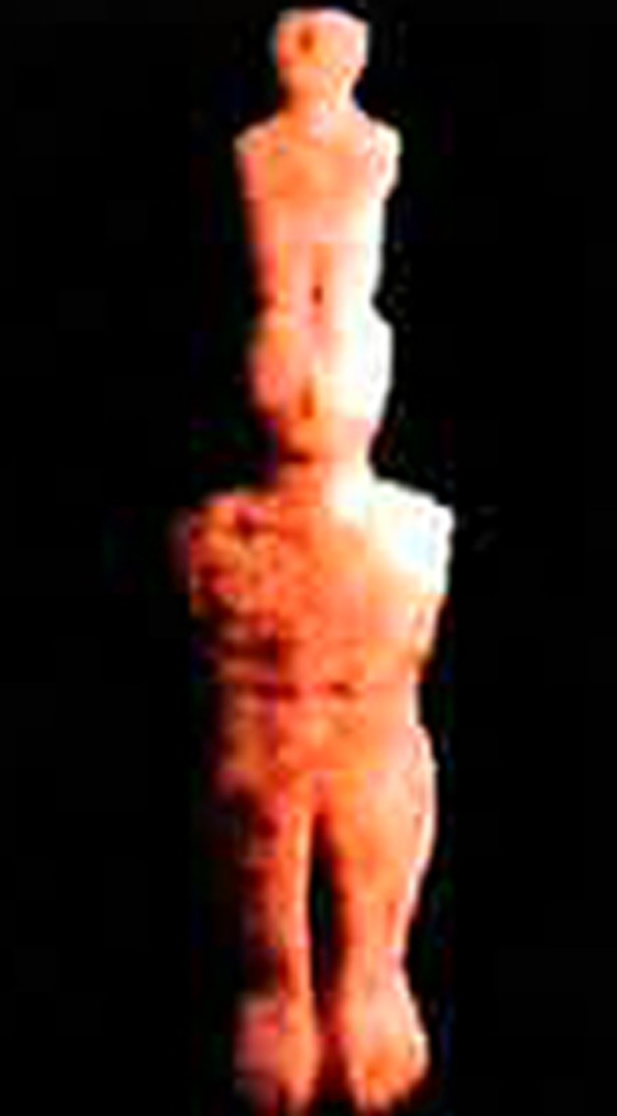 Συλλογή Στερν: Αυτές είναι οι κυκλαδικές αρχαιότητες της συλλογής του Αμερικανού κροίσου- Με ποιους όρους θα επιστρέψουν στην Ελλάδα