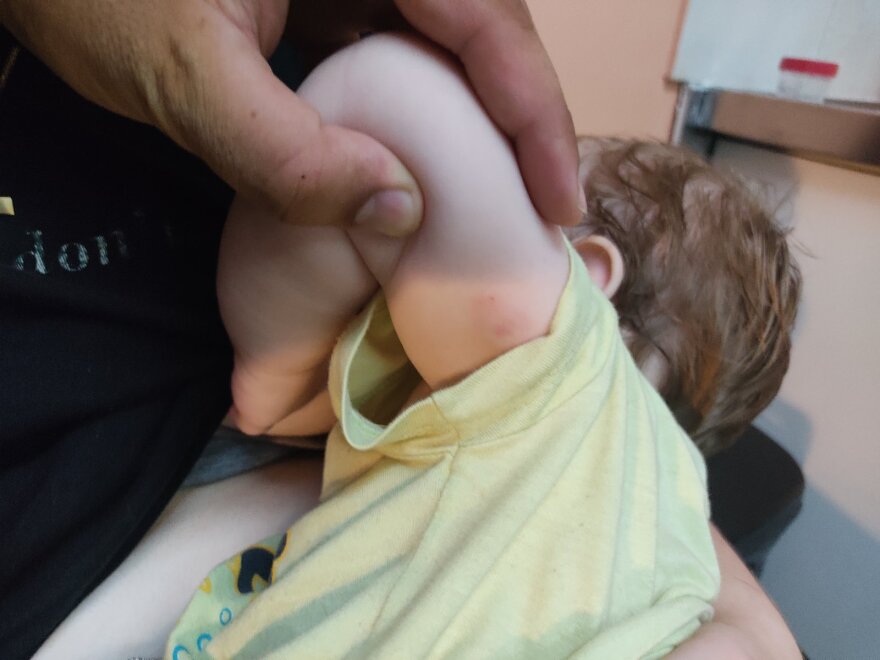 Κρήτη: Συγκλονίζει ο πατέρας του βρέφους για την επίθεση από λυκόσκυλο - «Δάγκωνε με μανία το παιδί μου»