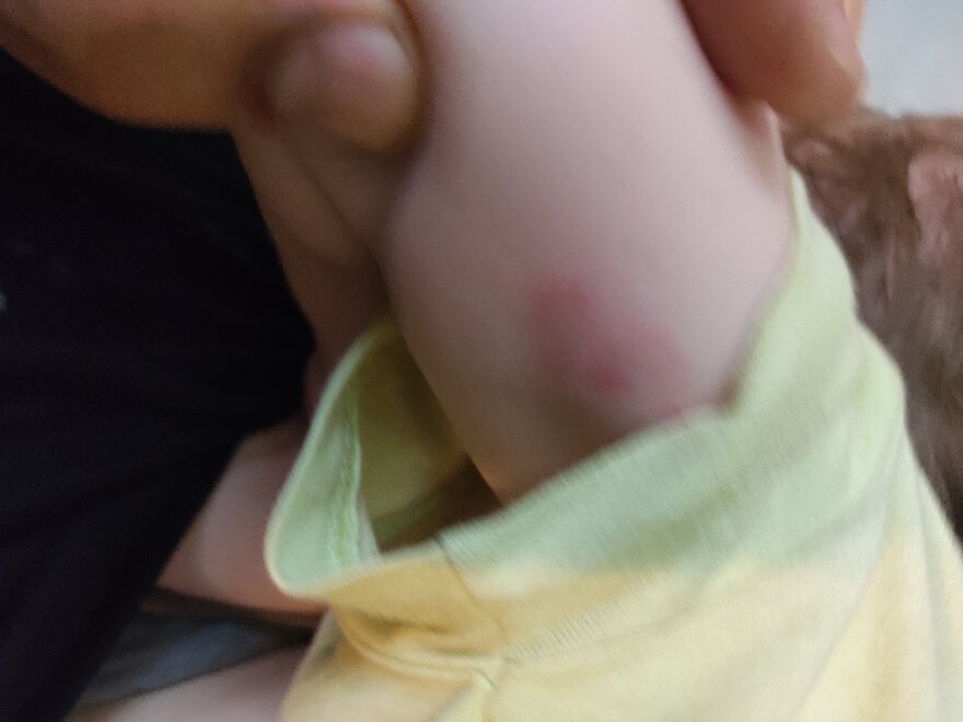 Κρήτη: Συγκλονίζει ο πατέρας του βρέφους για την επίθεση από λυκόσκυλο - «Δάγκωνε με μανία το παιδί μου»