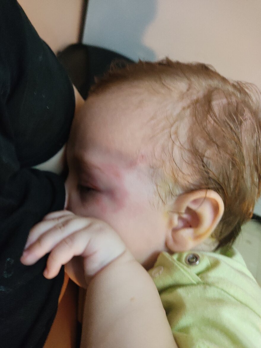 Κρήτη: Συγκλονίζει ο πατέρας του βρέφους για την επίθεση από λυκόσκυλο - «Δάγκωνε με μανία το παιδί μου»