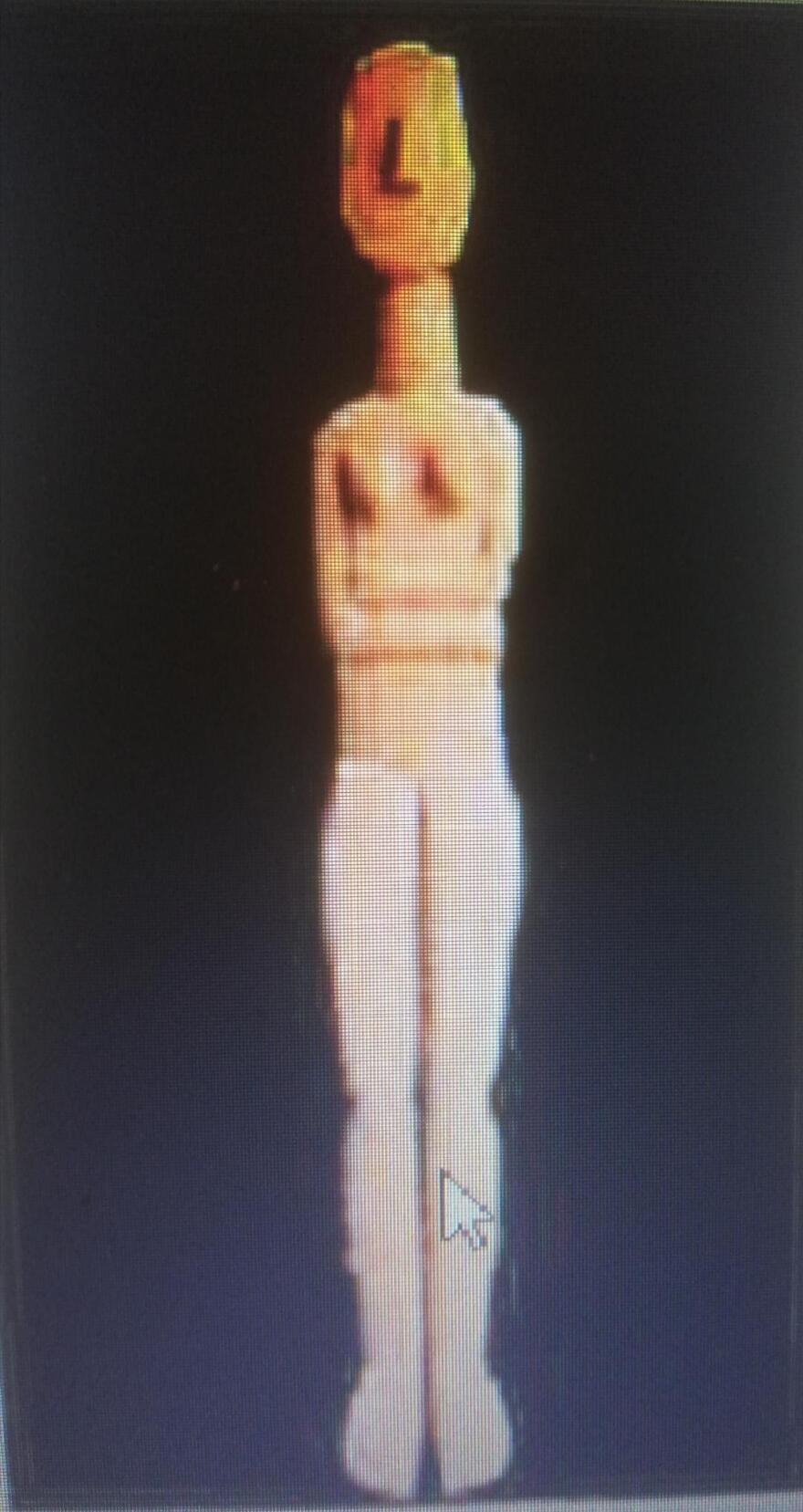 Συλλογή Στερν: Αυτές είναι οι κυκλαδικές αρχαιότητες της συλλογής του Αμερικανού κροίσου- Με ποιους όρους θα επιστρέψουν στην Ελλάδα