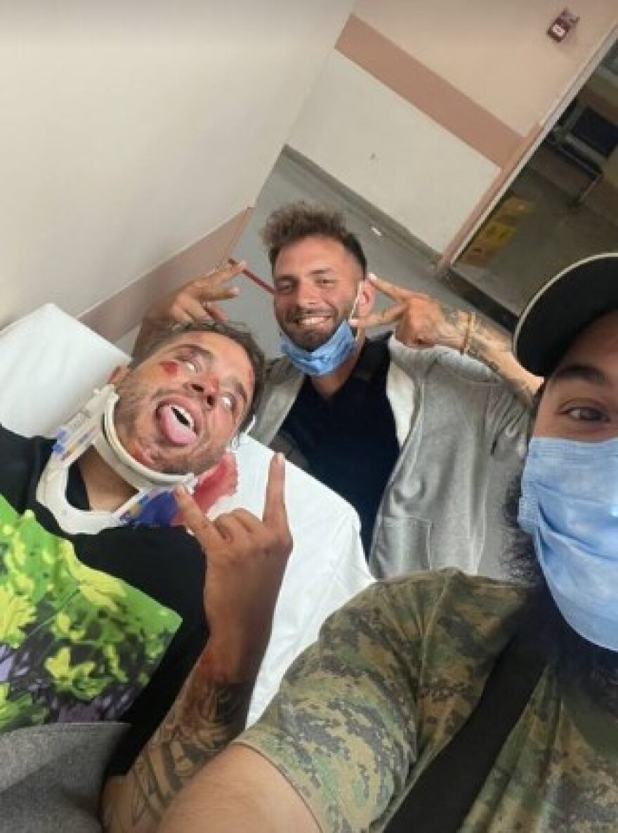 iLLEOo: Εσπευσμένα στο νοσοκομείο - Σοβαρό τροχαίο ατύχημα για τον τράπερ