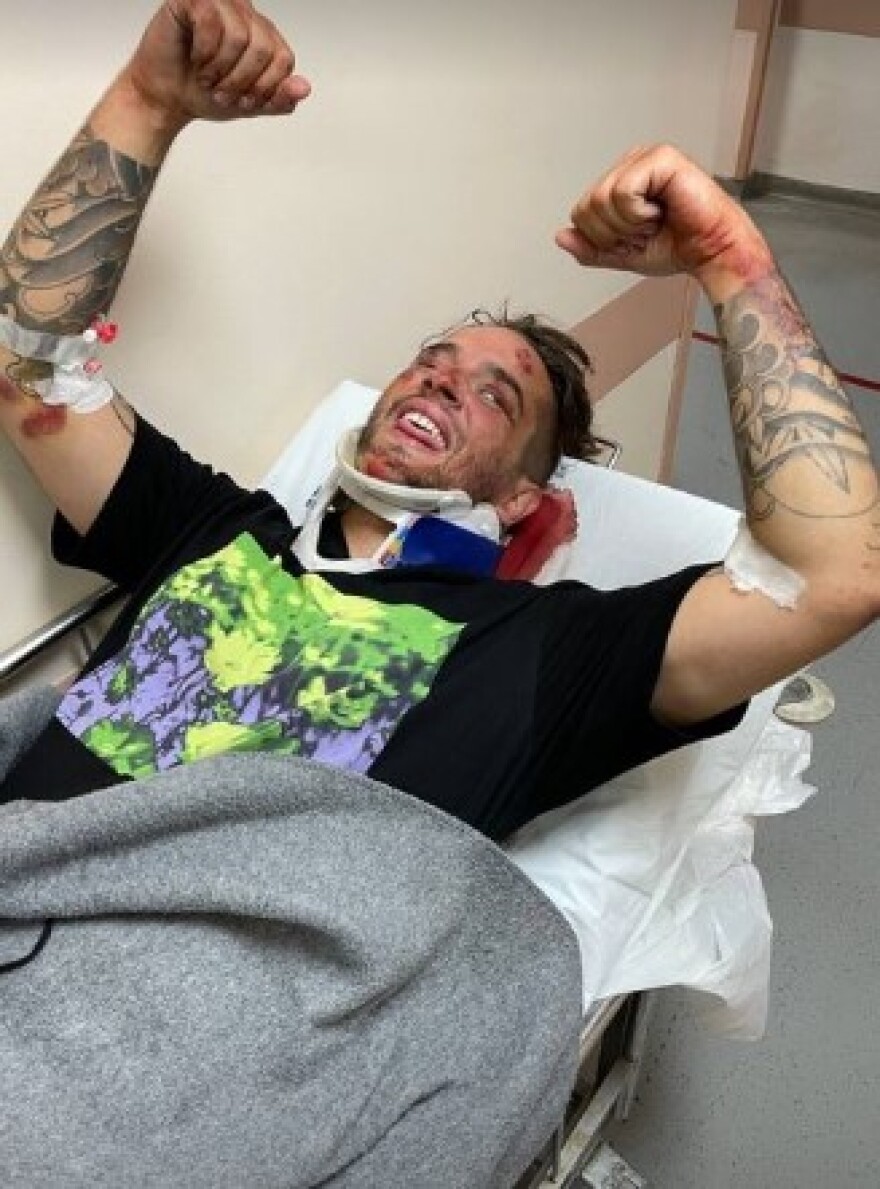 iLLEOo: Εσπευσμένα στο νοσοκομείο - Σοβαρό τροχαίο ατύχημα για τον τράπερ